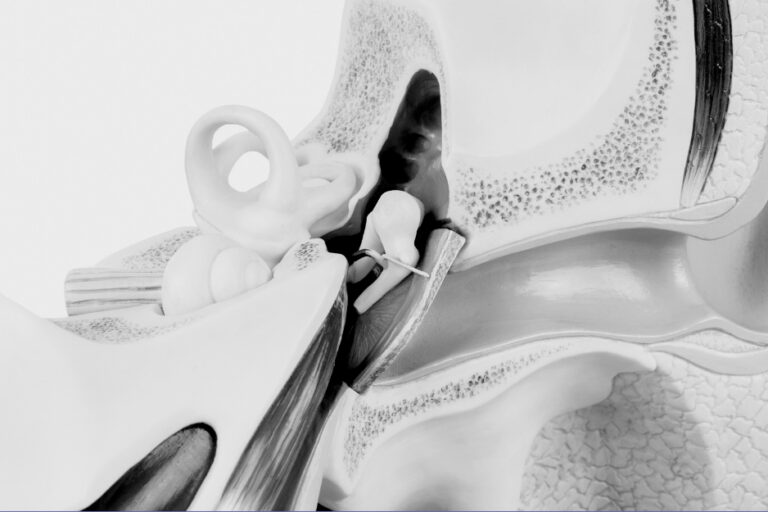 25° Ed. Anatomia chirurgica endoscopica dei seni paranasali e della base cranica