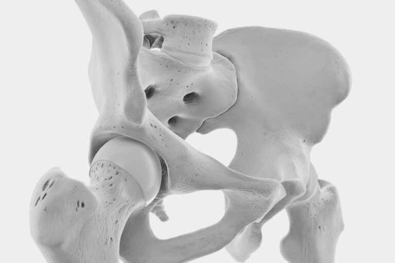 Corso Hand Trauma Essential 3° edizione 16-19.11.2026